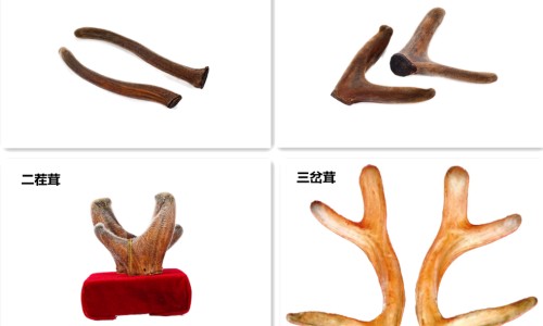 脑出血不会说话能恢复吗-脑出血恢复期间不喝水吗网 | 脑出血不会说话能恢复吗,脑出血恢复好了还会复发吗